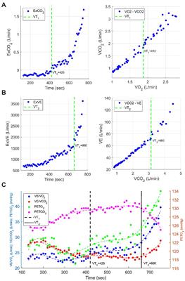 Novel Computerized Method for Automated Determination of Ventilatory Threshold and Respiratory Compensation Point